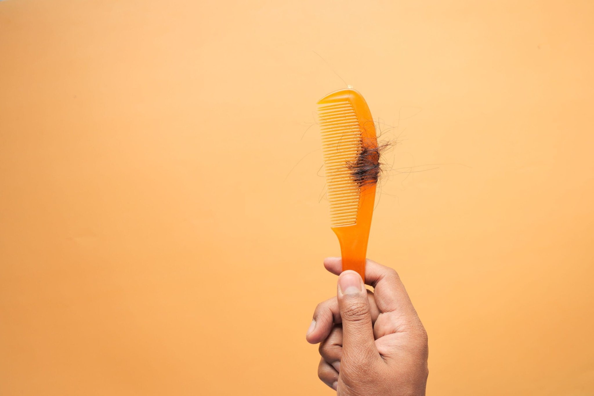 Before the Transplant: Why the Future of Hair-Loss Treatment Starts With Diagnosis