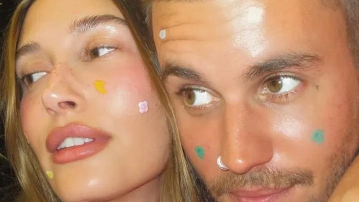 Hailey Bieber Is Healing Her Blisters With…Pimple Patches?