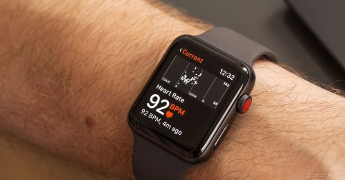 The Apple Watch heart monitor sends too many people to the doctor