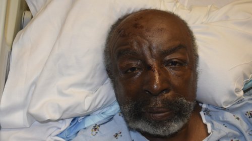 An Atlanta veteran with dementia got lost going shopping. He died months after an officer body-slammed him