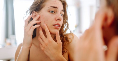 What spots on different parts of your face say about your health