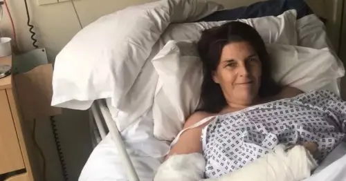 Woman survives brutal attack by 'UK's most dangerous animal' as she tells chilling tale