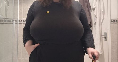 Llandudno woman with 40K bra size begs for breast reduction but NHS refuse