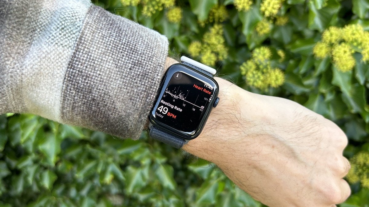APPLE WATCH ⌚️ |  cover image