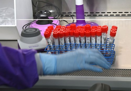 FDA says some lab tests are not reliable. It wants to change that.