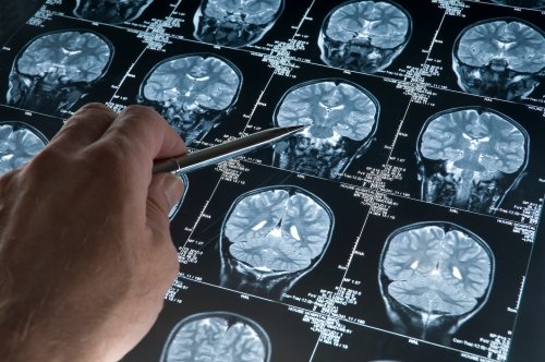Researchers tie health of nine organs to diseases later in life