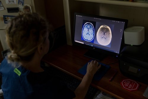 As Republicans weigh Medicaid work requirements, Georgia offers a warning