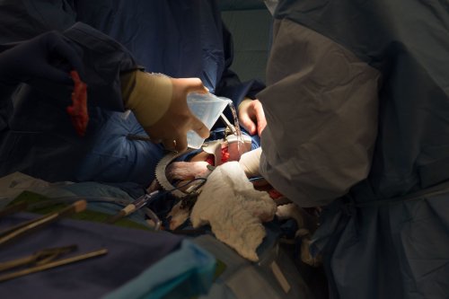 70 deaths, many wasted organs are blamed on transplant system errors