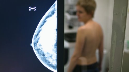Angriff auf die Frauengesundheit