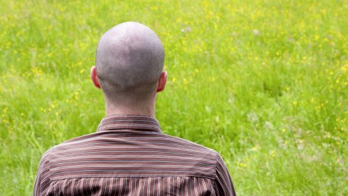 Genitalien schrumpfen nachdem Mann Mittel gegen Haarausfall nimmt