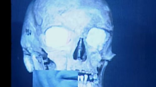 Perfekter "Monster"-Ersatz: Nächste True-Crime-Serie geht bei Netflix steil