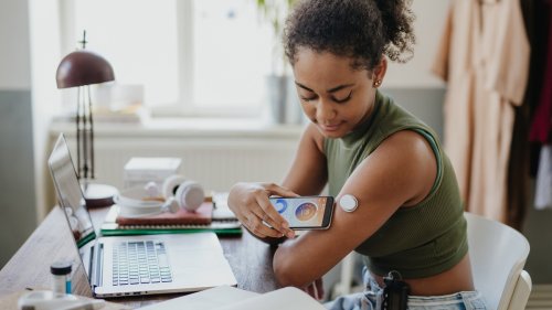 Tiktok-Trend: Glukose-Sensor kann zur Gesundheitsfalle werden