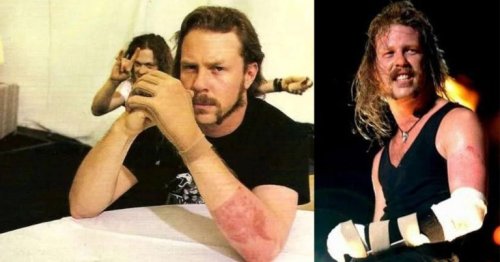 ‘And then the riot ensued’: Pyro Tech Talks About A Freak Accident That Badly Injured James Hetfield