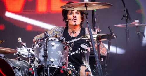 Tommy Lee Shares Gruesome Photos of His Recent Hand Surgery