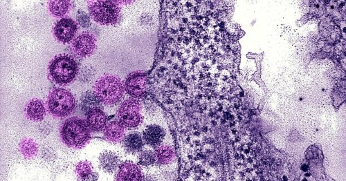 Löst tödliche Seuche aus: Wo kommt das Machupo-Virus vor?