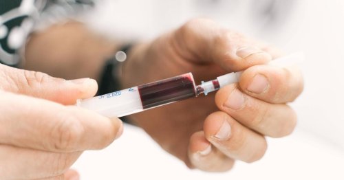 Bluttest erkennt Krebstumor-DNA: Diese drei News machen Hoffnung