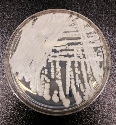 Candida auris: What you need to know about the deadly fungus spreading through US hospitals