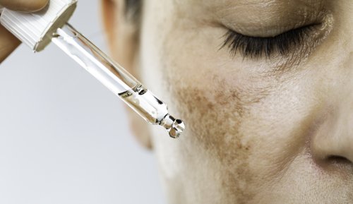 We’ve Reached the Golden Age of Treating Hyperpigmentation, and Our Routines Are All the Better For It