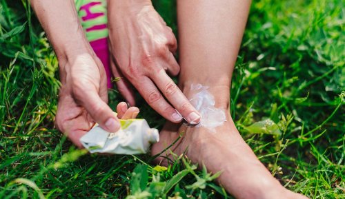 A Dermatologist Hates This Common Bug Bite Remedy—Here’s The Drugstore Product She Wants You To Use Instead