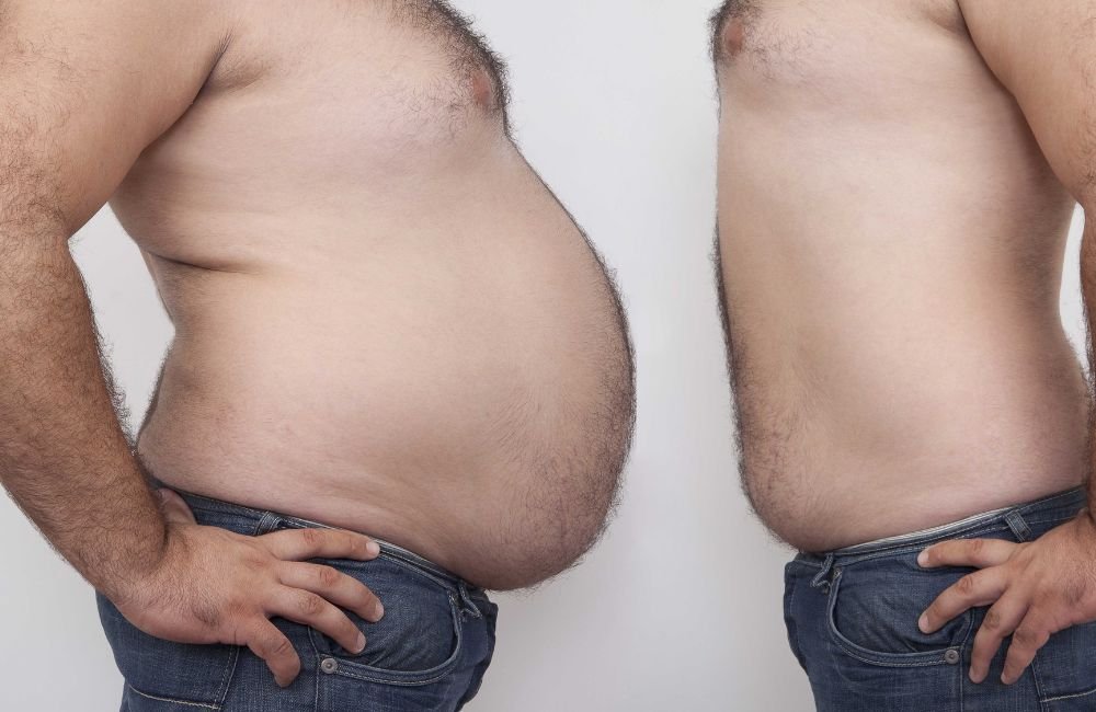 5 Proven Ways To Lose Visceral Fat Fast, Say Experts
