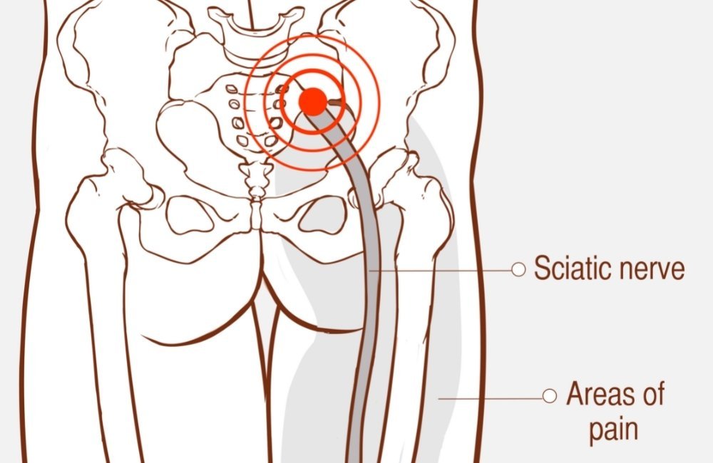 5 Best Stretches to Get Rid of Sciatica Hip and Lower Back Pain