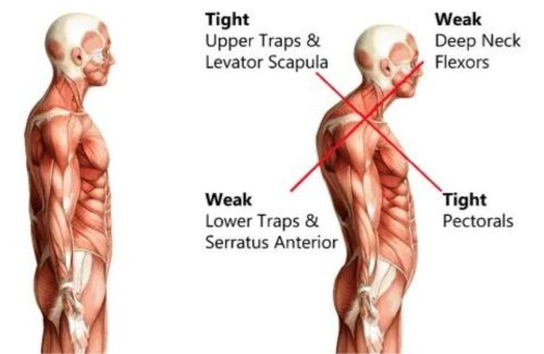 Do These 7 Stretches Every Day to Combat Rounded Shoulders, Sit Straighter, and Improve Your Range of Motion, Says a PT