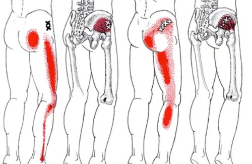 How To Get A Deep Piriformis Stretch To Get Rid Of Sciatica, Hip & Lower Back Pain