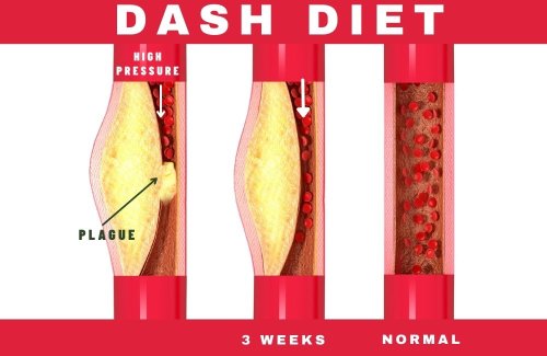 The Dash Diet Is Proven To Reduce Heart Disease and High Blood Pressure
