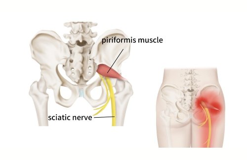 This Piriformis Muscle Stretch Helps Rid of the Nerve Pain and Tension in Your Glutes and Legs