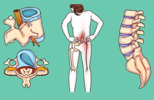 A Surgeon Reveals Exercises that Can Heal Your Spine Before It’s Too Late