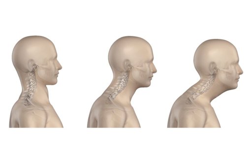 3 Exercises That’ll Help You Get Rid of Forward Neck Posture (Text Neck)