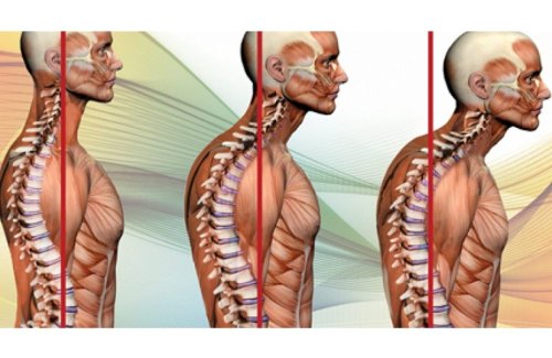 7 Exercises That’ll Help Get Rid of Dowager’s Hump and Fix Your Neck Posture