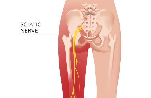 3 Simple Stretches To Get Rid of Sciatica, Hip, and Lower Back Pain