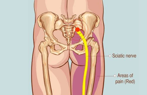 The 5 Best Exercises to Get Rid of Sciatica Pain In the Hip and Lower Back￼￼￼
