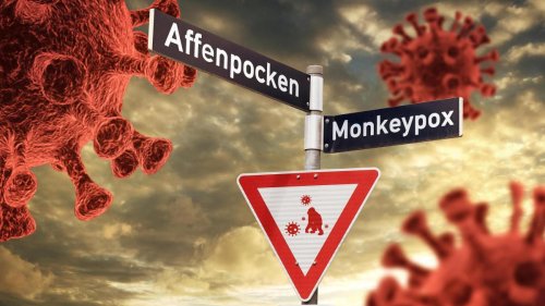Warum die Affenpocken nicht die nächste Pandemie verursachen