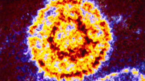 Weit verbreitete Herpesviren verursachen Multiple Sklerose