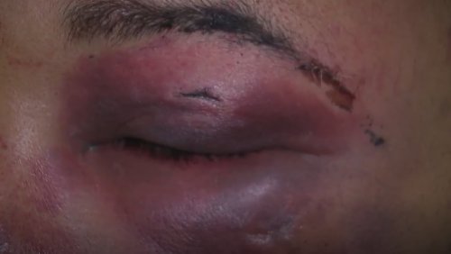 ‘I didn’t think I was going to make;’ Ohio man seeking answers after being jumped during night out