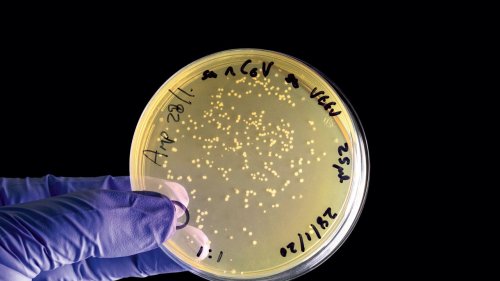 This coronavirus vaccine would be two breakthroughs in one