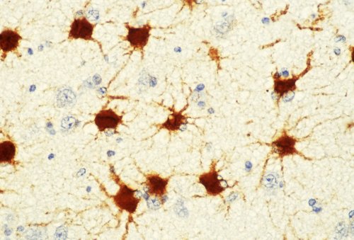 [WEB] To Understand Brain Disorders, Consider the Astrocyte