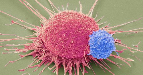 The Most Promising Cancer Treatments In a Century Have Arrived—But Not For Everyone