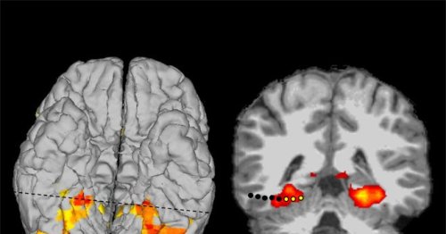 A Patient's Bizarre Hallucination Points to How the Brain Identifies Places