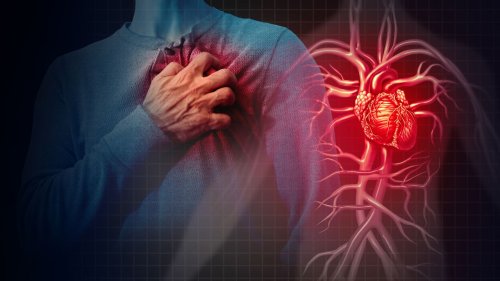Qué es y cómo reconocer los síntomas de un infarto de miocardio