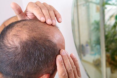 Researchers develop new and faster way to regrow hair due to male-pattern baldness