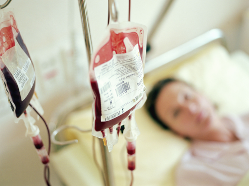 Alzheimer’s disease could be reduced by 80% through blood transfusions