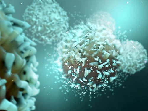 Tumor-targeting "micro-bubbles" destroy cancer cells like exploding smart warheads
