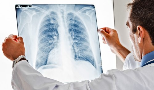 Breakthrough study finds that Zinc supplements can heal lung damage