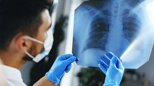 Zinc reverses lung damage and greatly improves patient survival