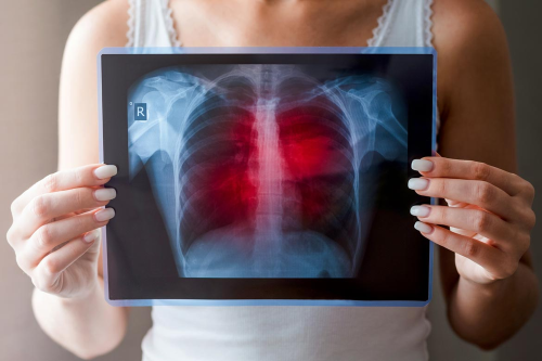 Zinc reverses lung damage and improves patient survival, research finds