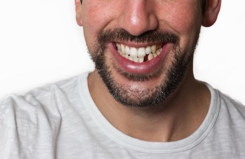 World's first drug to regrow teeth is now in clinical trials