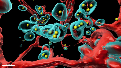New technology makes cancerous tumors eliminate themselves